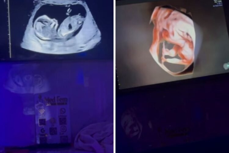 Bia Miranda ultrassom